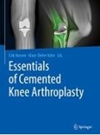 Bild von Essentials of Cemented Knee Arthroplasty von Kühn, Klaus-Dieter (Hrsg.) 
